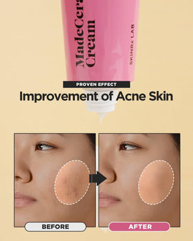 BEISIKS product label highlighting ingredients like ceramide and madecassoside