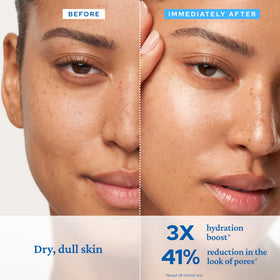 belif product with panthenol and niacinamide highlighting soothing benefits