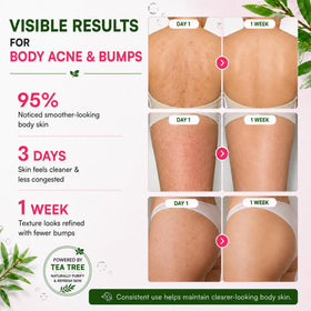 BellamiLuxx used on back in shower to cleanse clogged pores