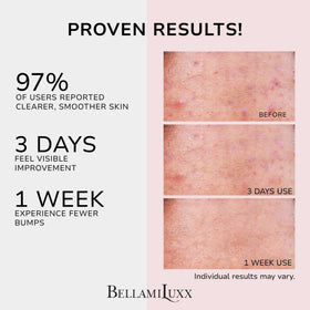 BellamiLuxx ingredient flatlay with salicylic acid and tea tree for pore cleansing
