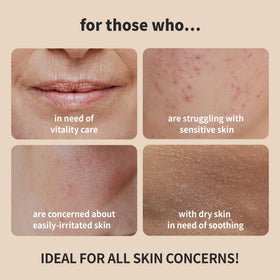 BENTON close-up of the clear essence texture demonstrating lightweight hydration