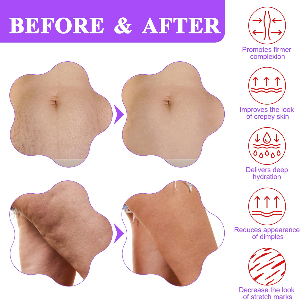 BETTENKO applied to stomach demonstrating targeted firming routine