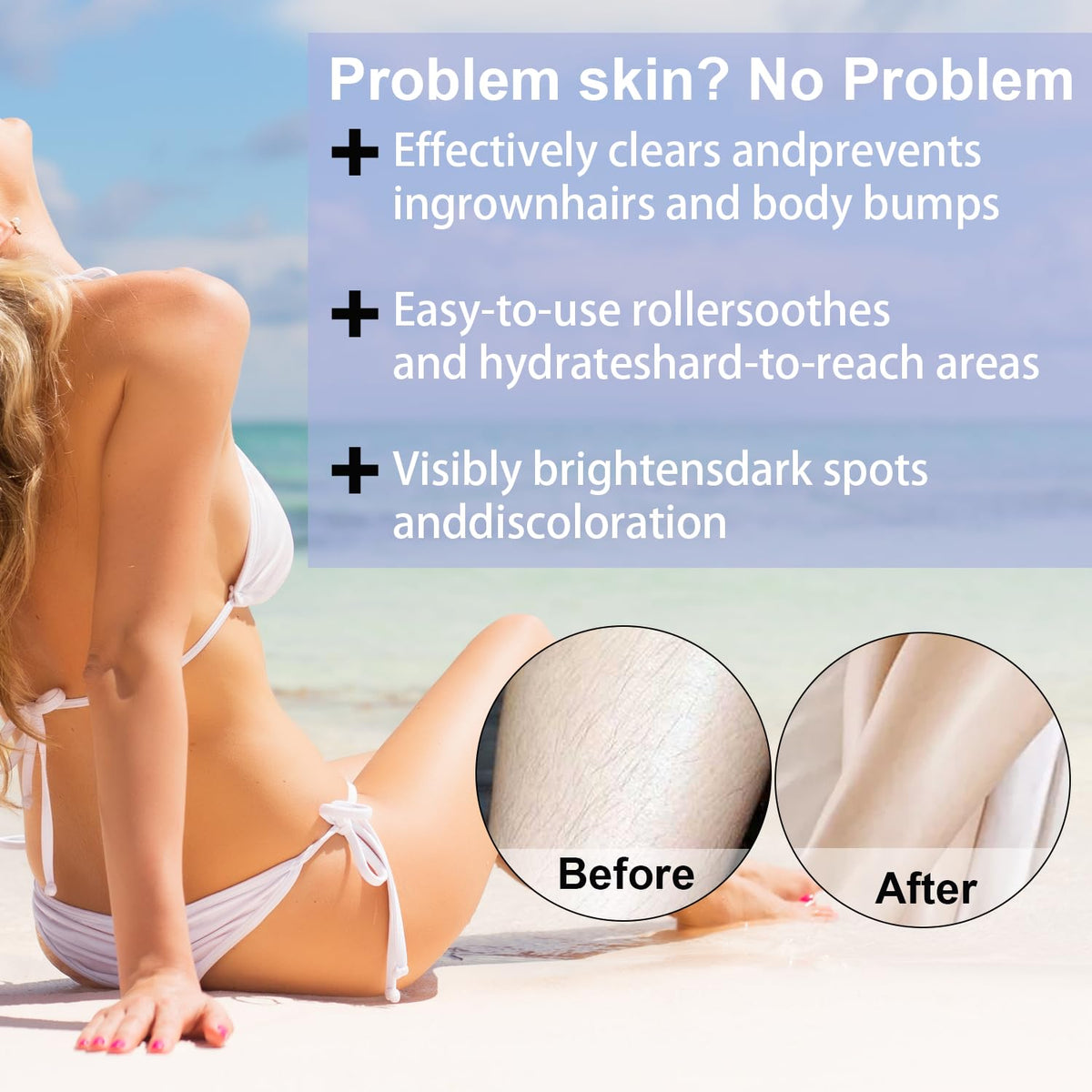 BETTENKO applied to bikini area demonstrating soothing comfort