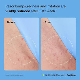 BETTENKO serum texture pool illustrating lightweight absorbency benefit