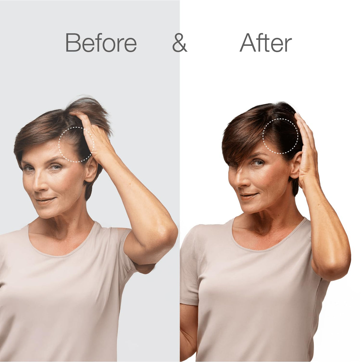 Better Not Younger applying serum to scalp demonstrating targeted nourishment