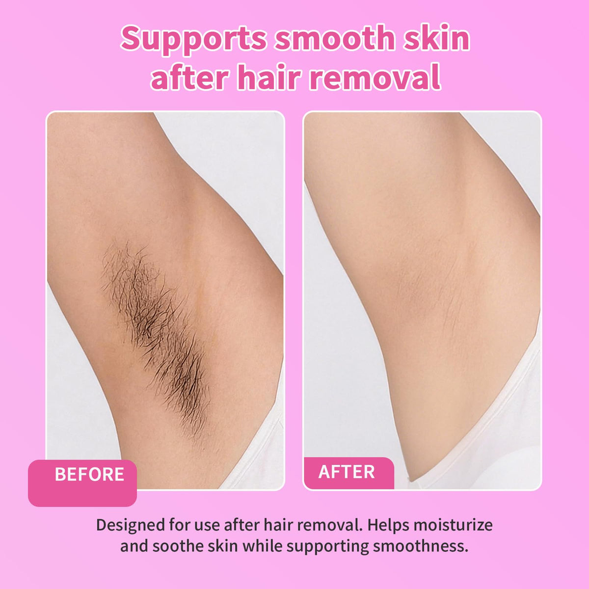 Beuifvo LUM being applied to leg demonstrating soothing post-hair-removal comfort benefit