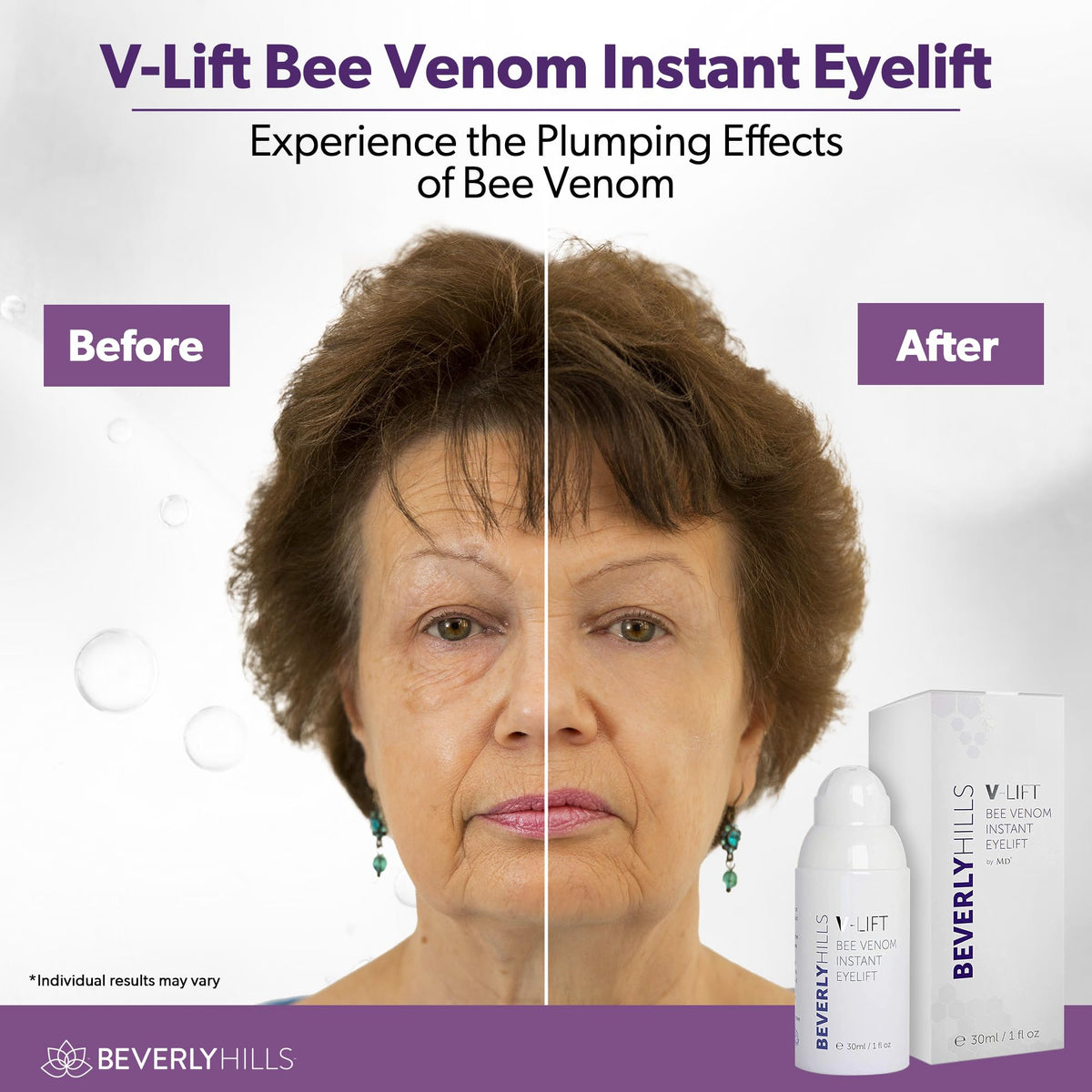 BEVERLY HILLS ingredient focus on bee venom vial illustrating natural active support
