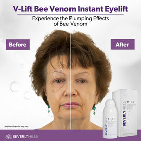 BEVERLY HILLS ingredient focus on bee venom vial illustrating natural active support
