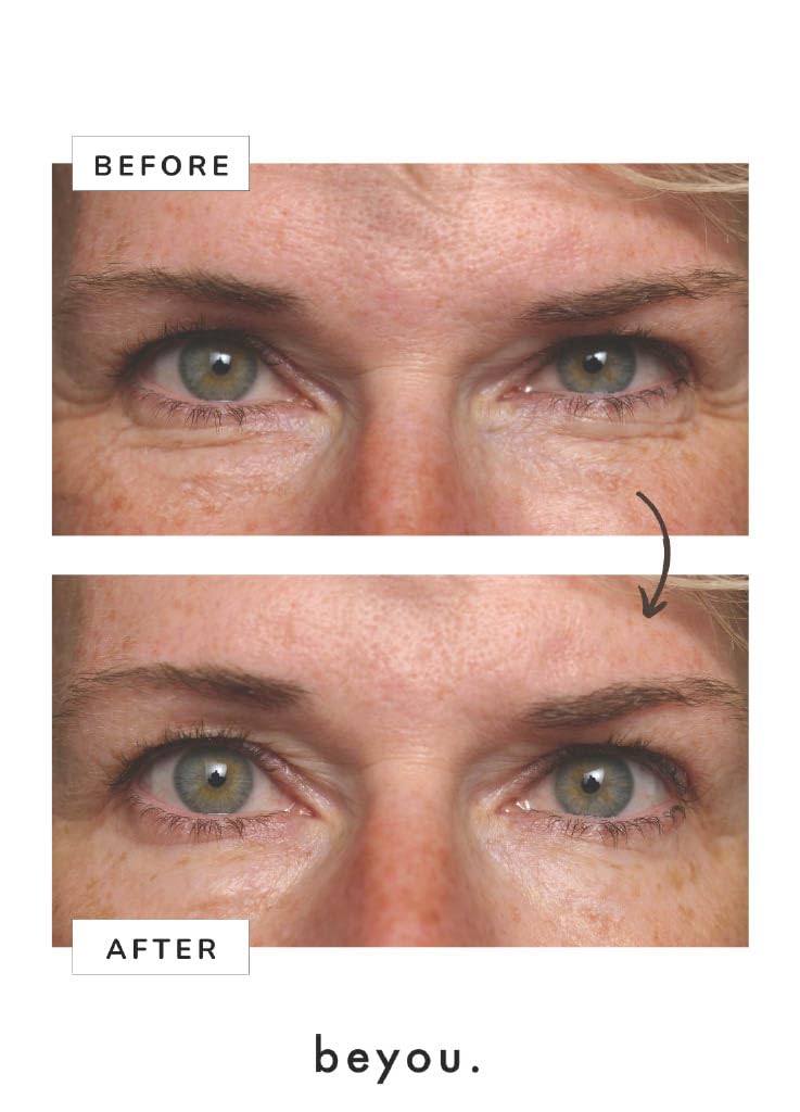 Beyou cream on fingertip ready to apply, demonstrates easy application and gentle touch benefit