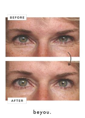 Beyou cream on fingertip ready to apply, demonstrates easy application and gentle touch benefit