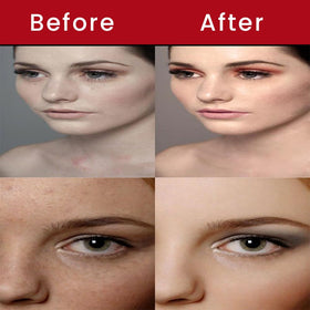 Bio Mystery gel applied to cheek demonstrating targeted spot treatment