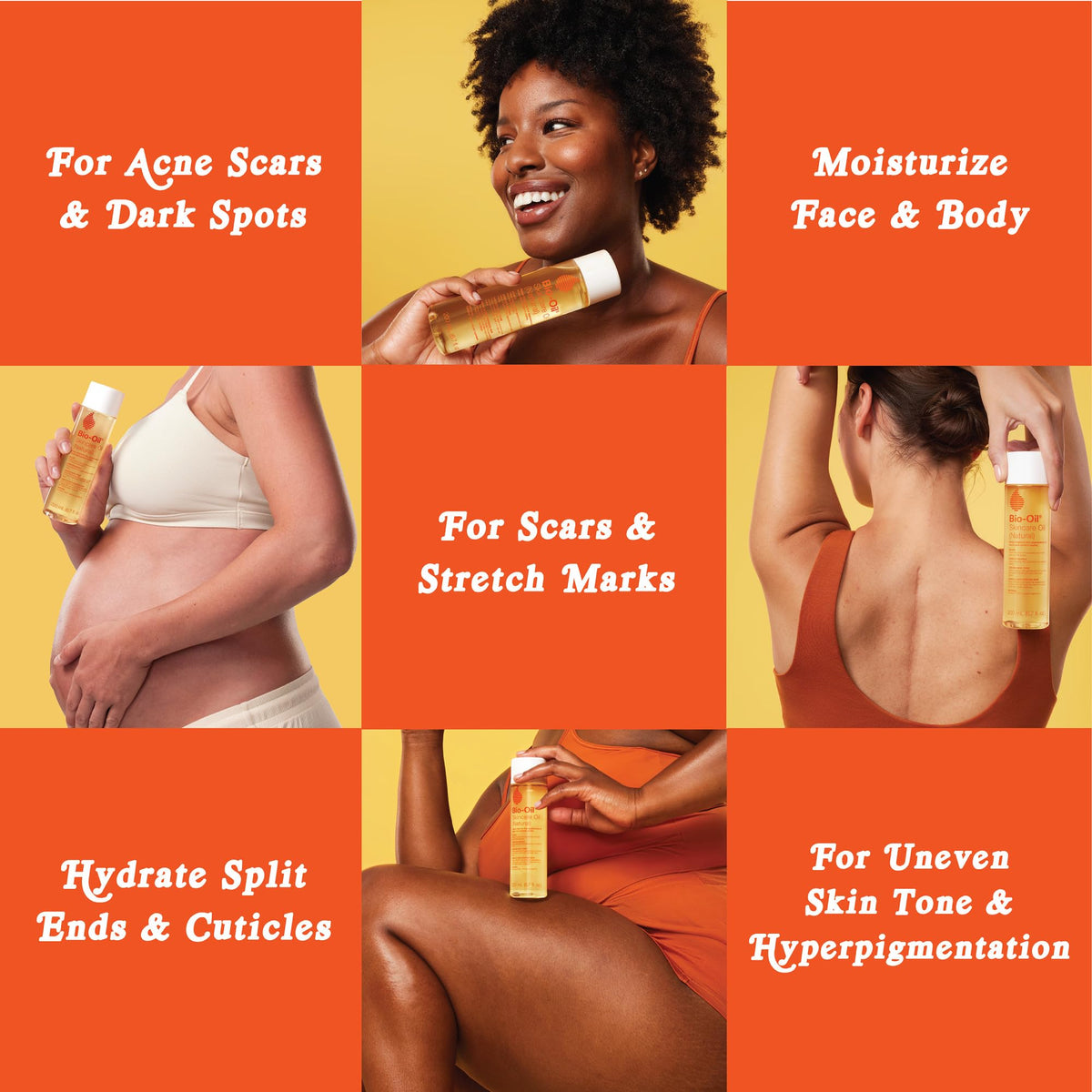 Bio-Oil application on stretch mark area showing targeted hydration