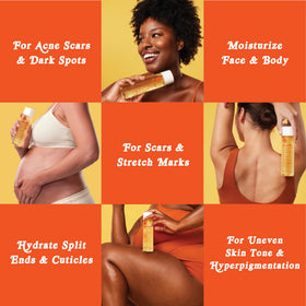 Bio-Oil application on stretch mark area showing targeted hydration