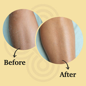 Bioactive Skin Rescue targeted application on cheek demonstrating gentle hydration