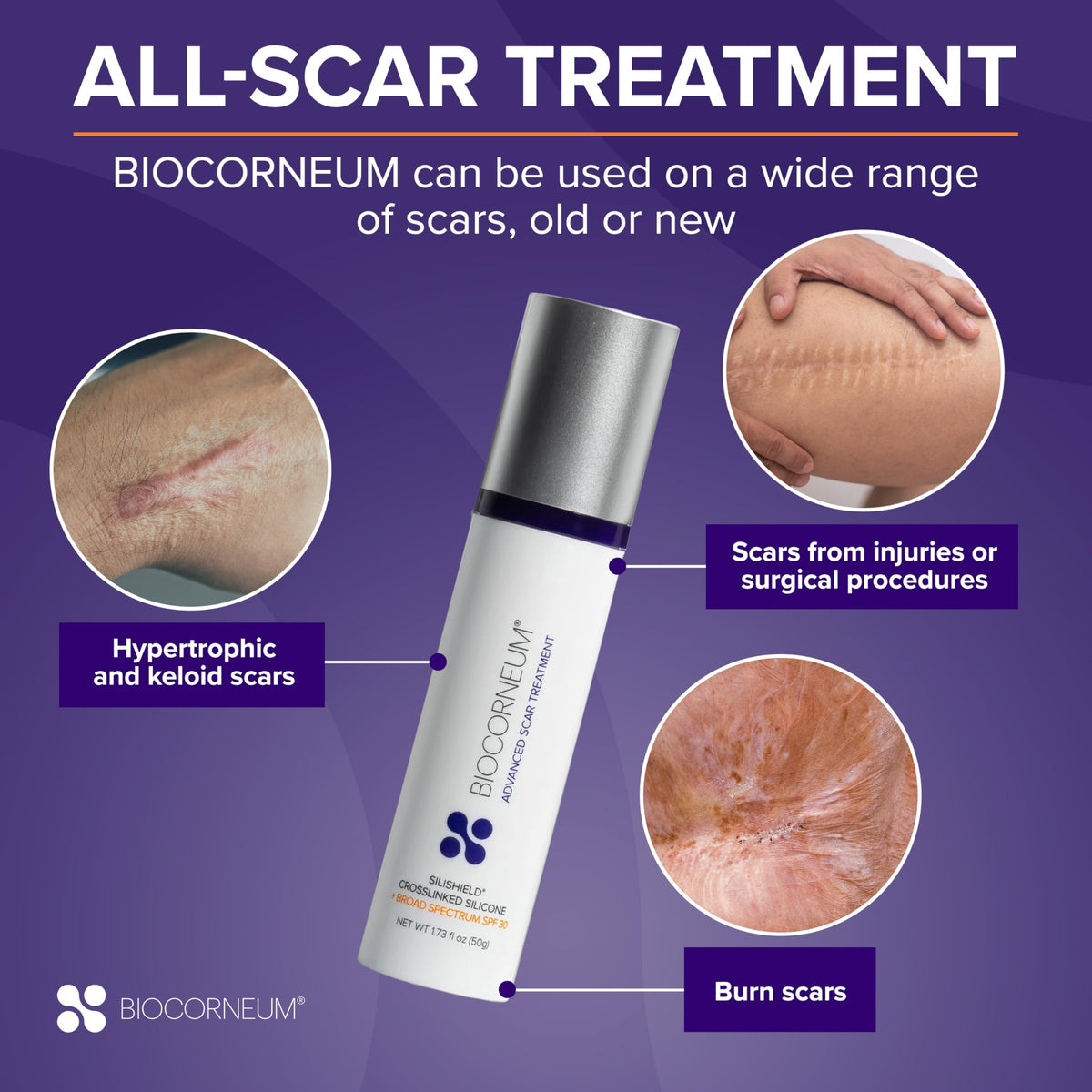 BIOCORNEUM applied to facial scar showing discreet coverage benefit