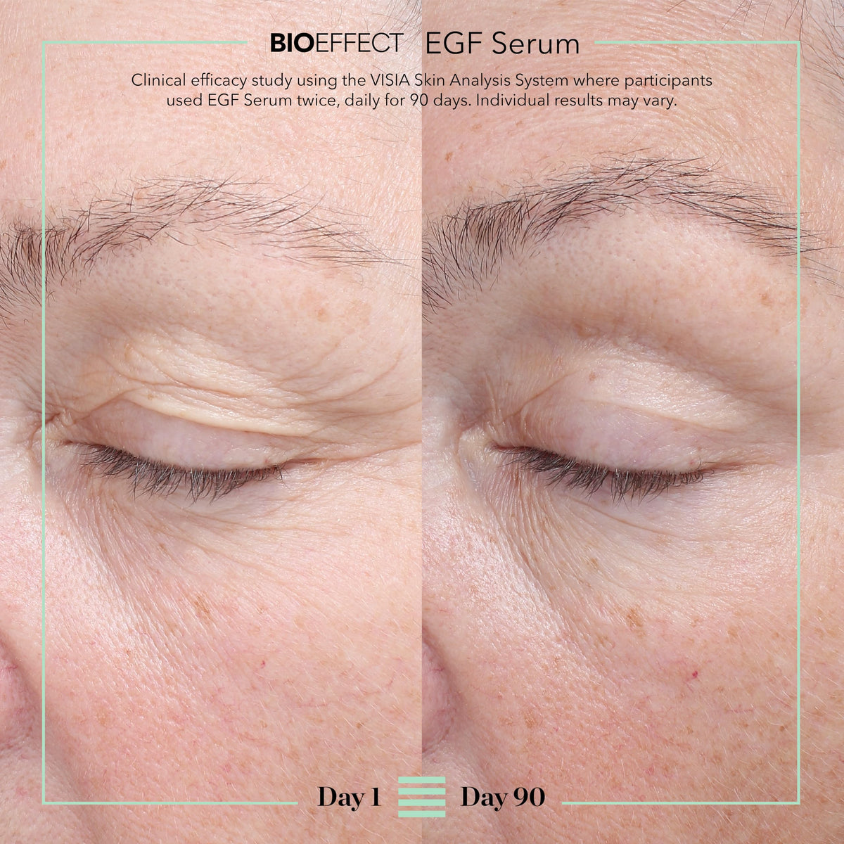 BIOEFFECT serum texture on pipette showing lightweight hydrating consistency benefit