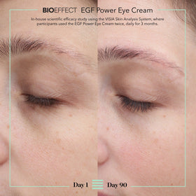 Bioeffect ingredient vial with Barley EGF visualizing biotech origin and skin renewal benefit