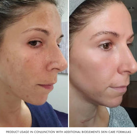 Bioelements moisturizer in hand being applied for even, non-greasy feel