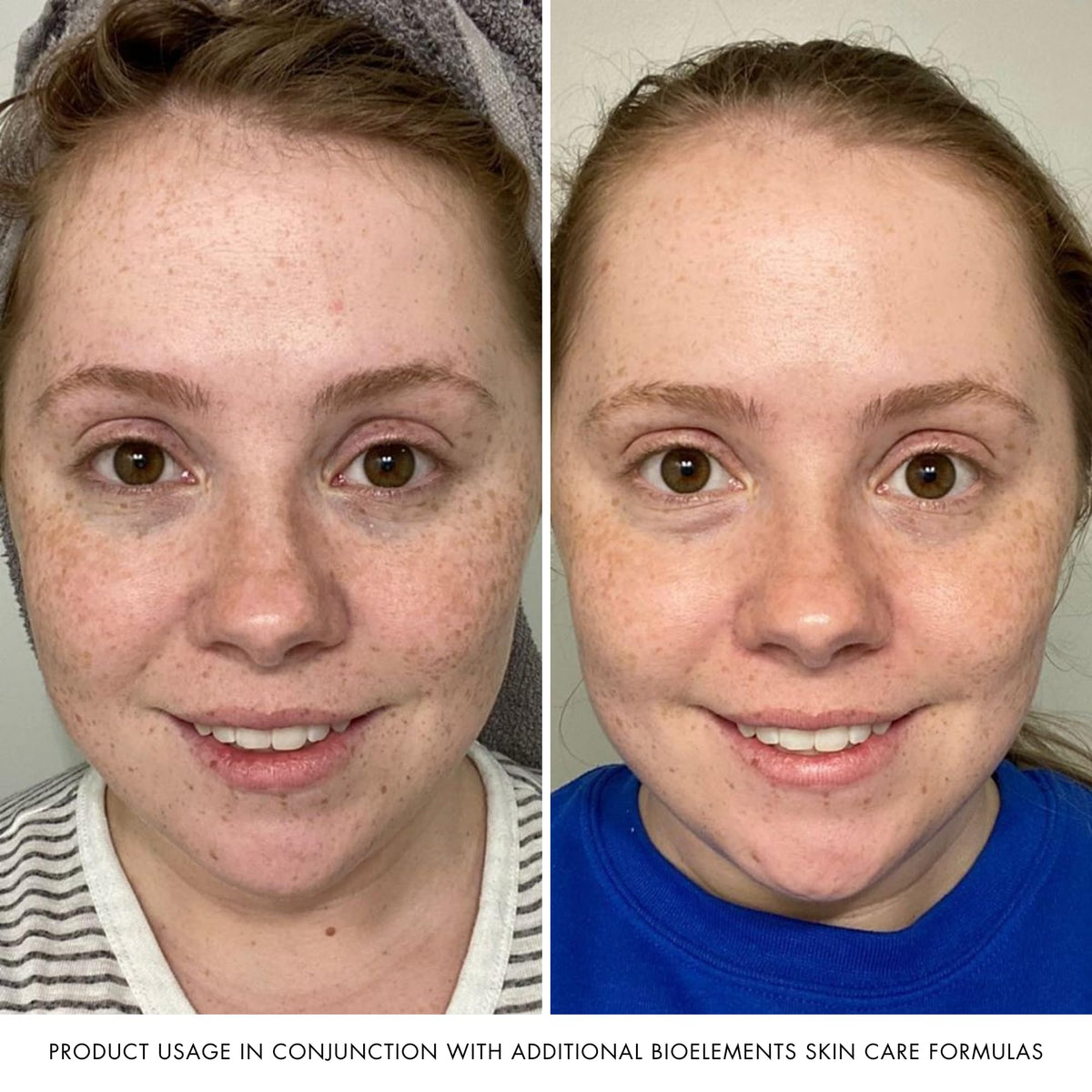 Bioelements gel spread on skin illustrating non-greasy finish and comfortable hydration