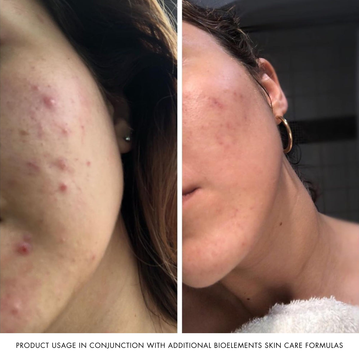 Bioelements toner spritz on cheek showing immediate hydration benefit