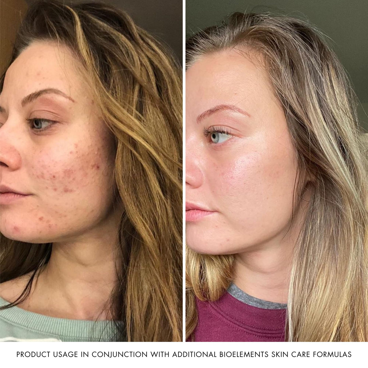Bioelements RayDefense 4 fl oz next to everyday items to show true size and portability