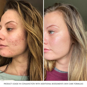 Bioelements RayDefense 4 fl oz next to everyday items to show true size and portability