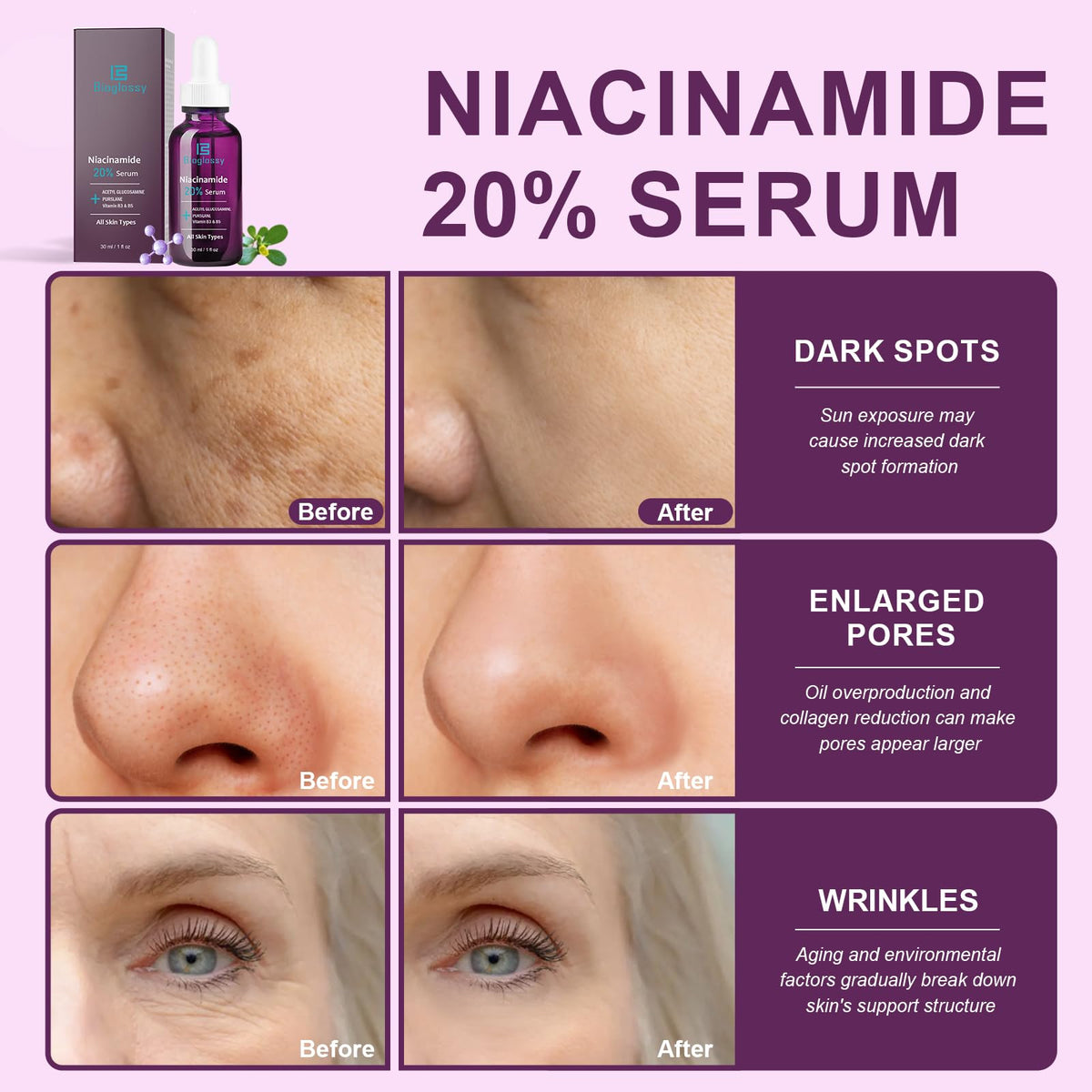 Bioglossy ingredient bottle highlighting niacinamide and hyaluronic acid benefit