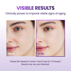 BIOHEAL BOH 3D-fitting sheet close-up highlighting contour fit for lower-face lifting