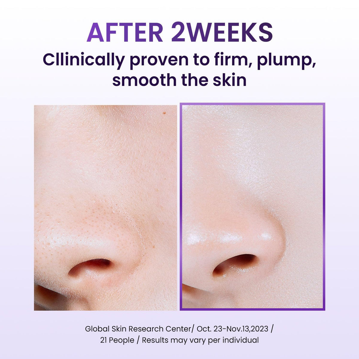 BIOHEAL BOH cream on spoon demonstrating lightweight, fast-absorb benefit