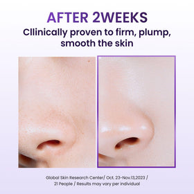 BIOHEAL BOH cream on spoon demonstrating lightweight, fast-absorb benefit