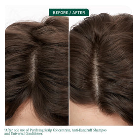 Biolage bottle dispensing concentrate onto fingertip demonstrating easy application