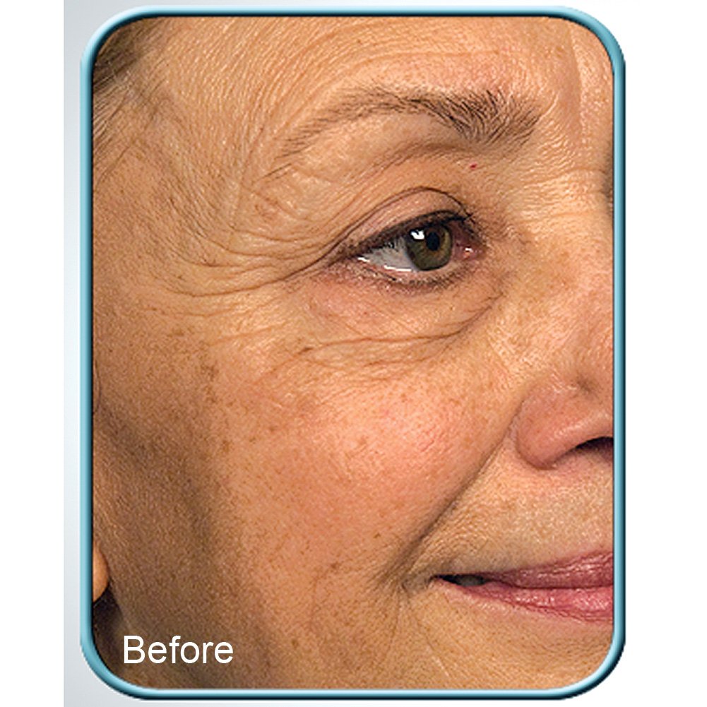 Biologic Solutions cream texture closeup showing smooth consistency for easy absorption
