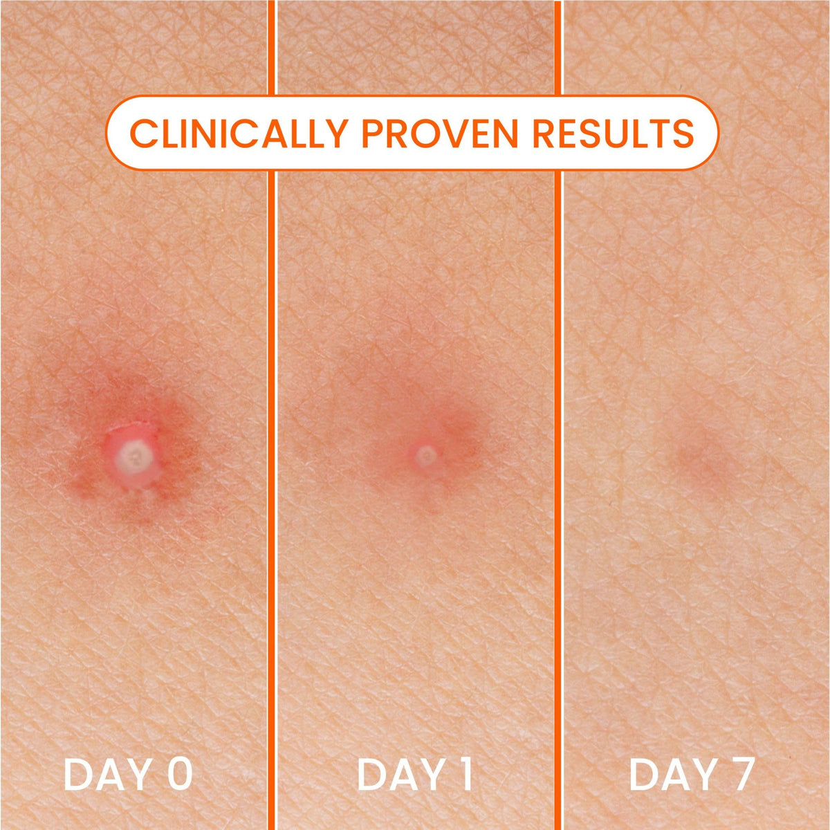 Biore patch used at night on pillow showing overnight absorbency benefit