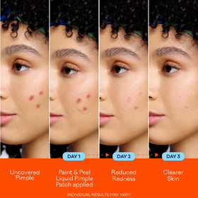Bioré painted patch in nose crevice targeting hard-to-reach blemishes