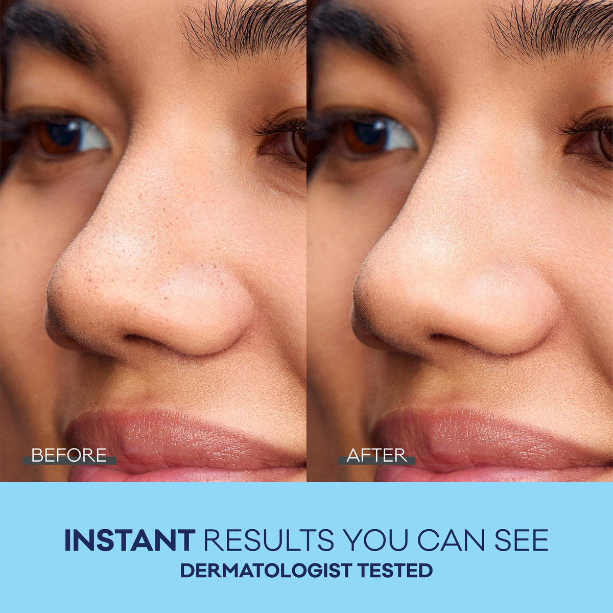 Bioré peeled strip with extracted blackheads showing visible removal benefit