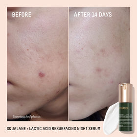 BIOSSANCE dropper dispensing clear serum texture for hydrated, refined complexion