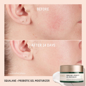 Biossance gel dispensed on fingertip demonstrating easy application and control