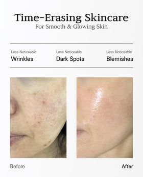 BLANC DUBU ampoule vial close-up highlighting applicator and concentrated formula benefit
