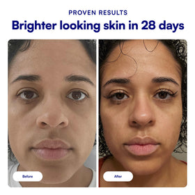 Side-by-side Bliss before and after concept illustrating brightened tone