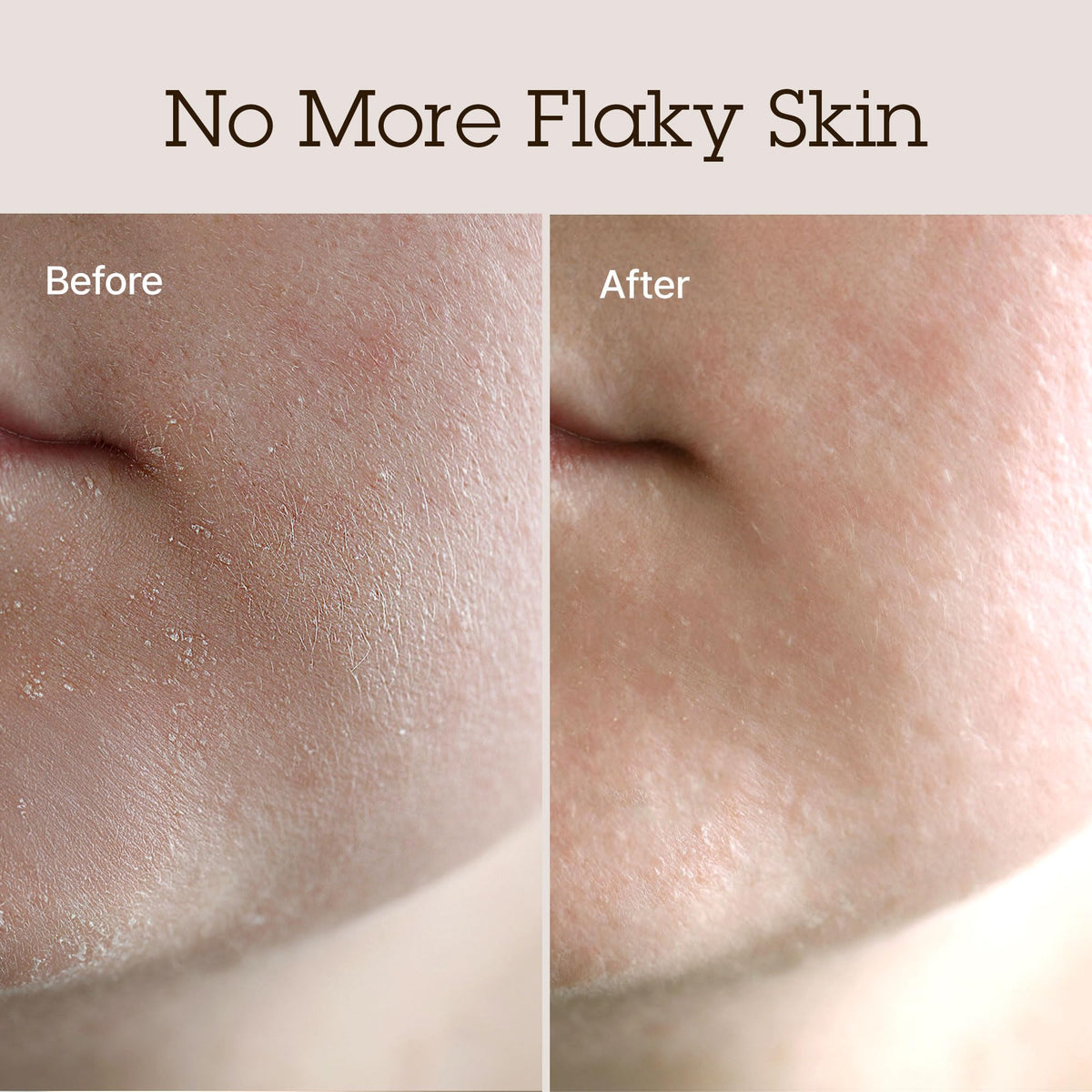 BLITHE shea butter closeup emphasizing nourishing fatty acids for dry skin