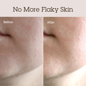 BLITHE shea butter closeup emphasizing nourishing fatty acids for dry skin