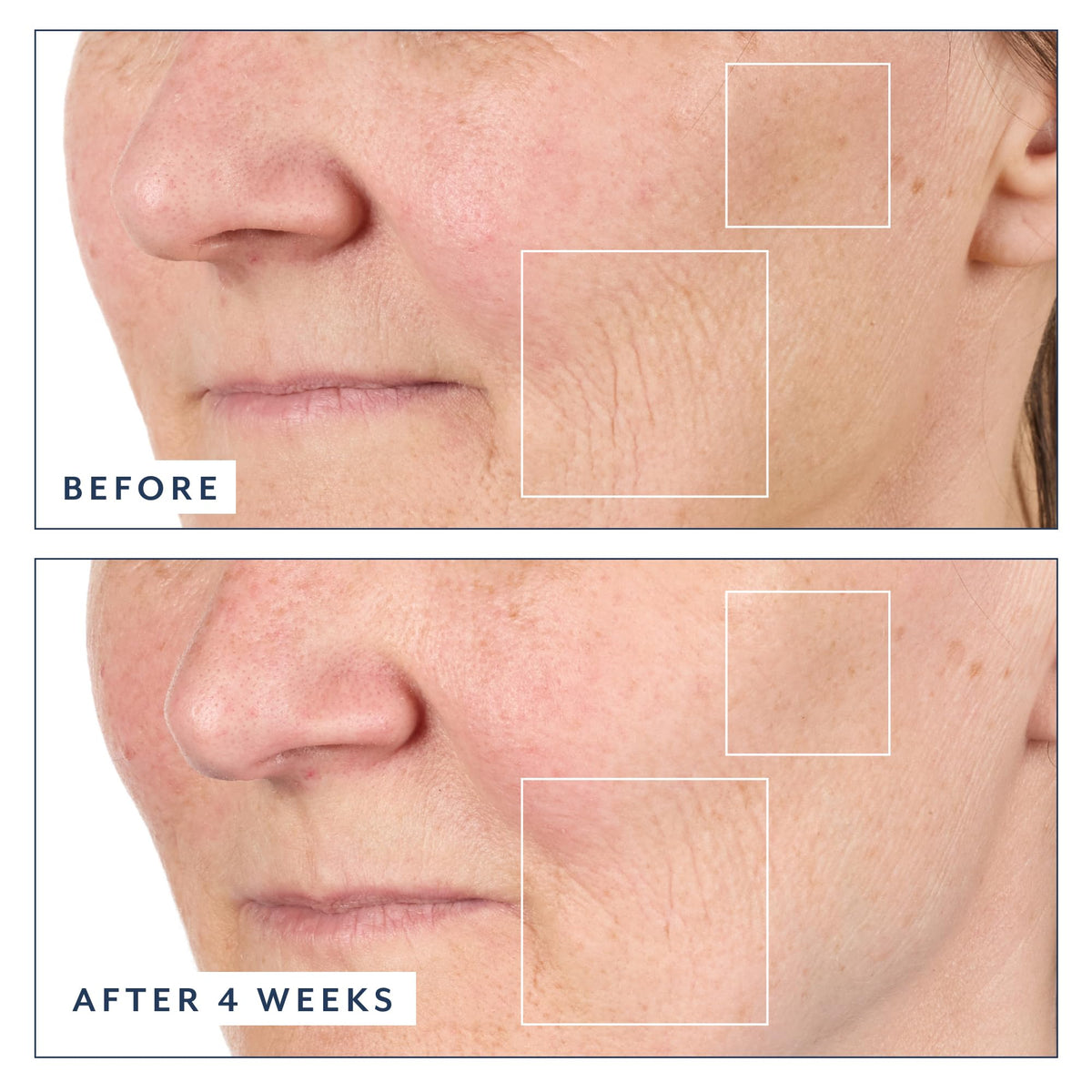 Bloomeffects application demo on face and neck demonstrating easy absorption benefit