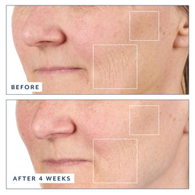 Bloomeffects application demo on face and neck demonstrating easy absorption benefit