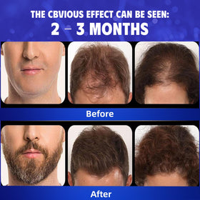 Blue Sea Sky precision dropper applying serum directly to a scalp part for targeted treatment