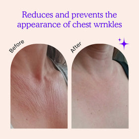 BLUMBODY close-up of silicone texture showcasing gentle adherence