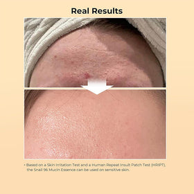 Blusheva Beauty serum on hand application illustrating lightweight absorption