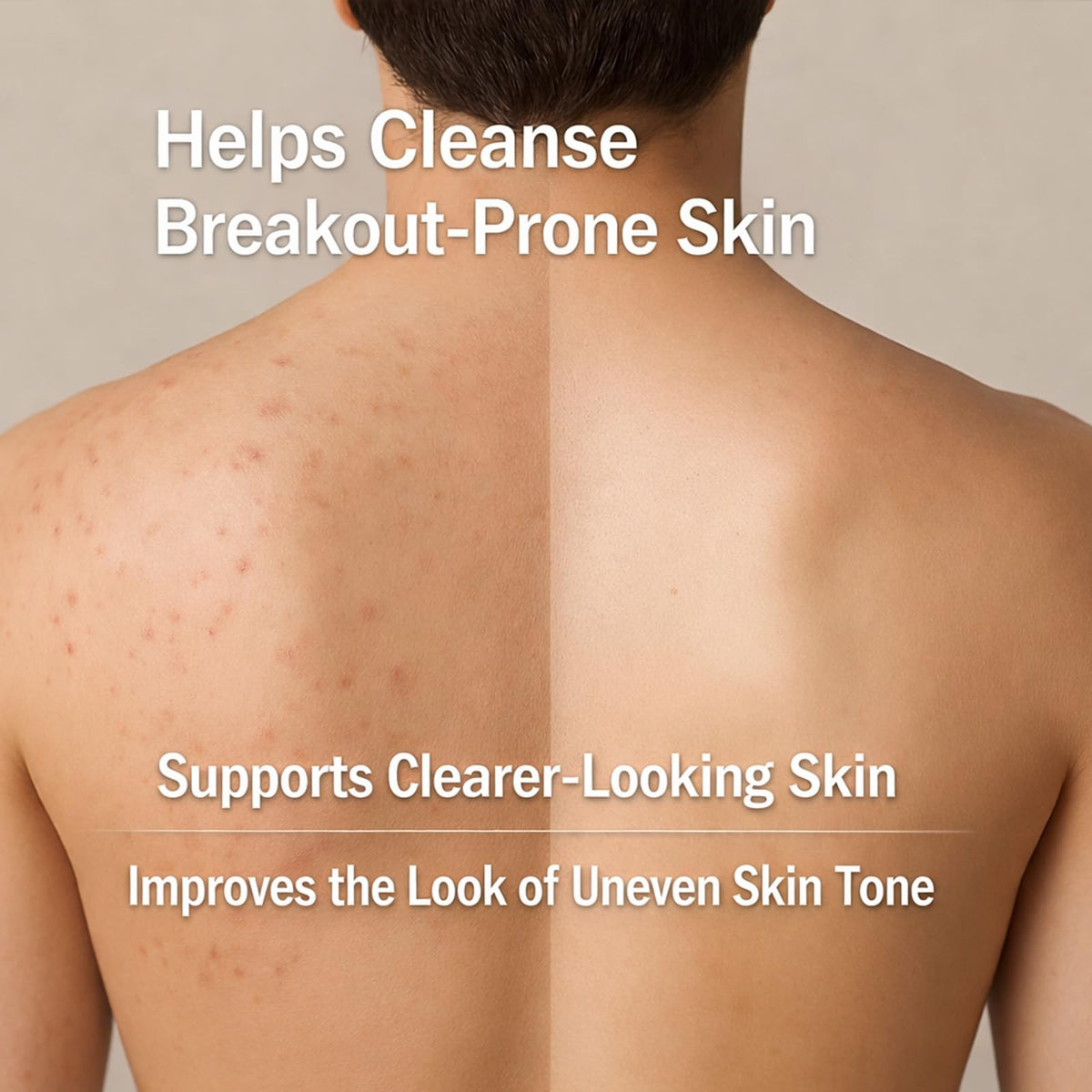 Boaccy ingredient panel highlighting niacinamide glycolic acid ceramides