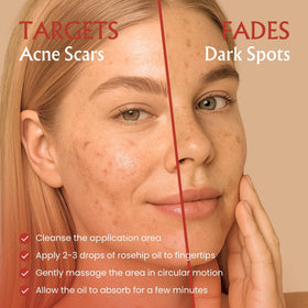BodyJ4You hands massaging oil into facial skin for hydration