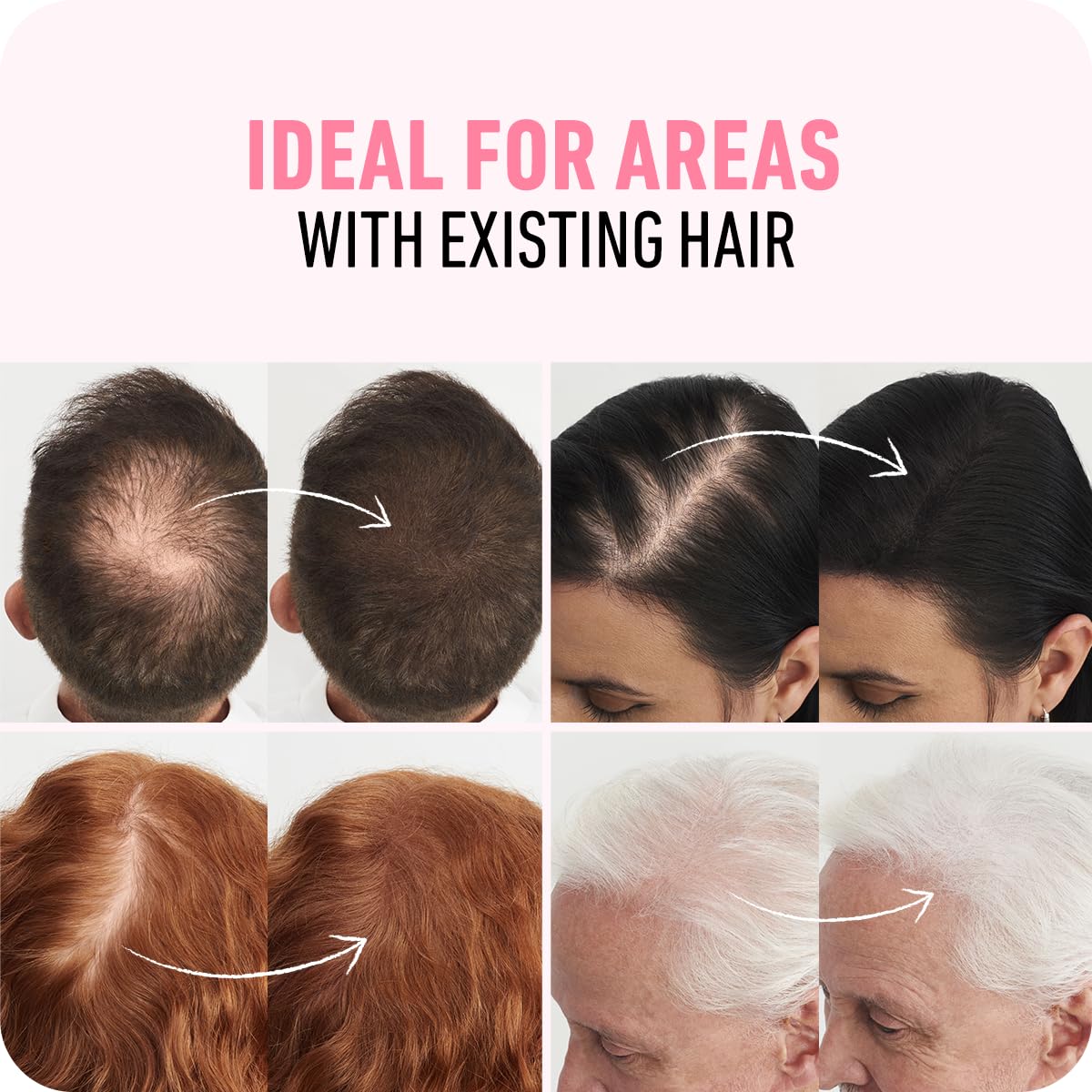 Boldify applying fibers to crown showing instant fuller appearance