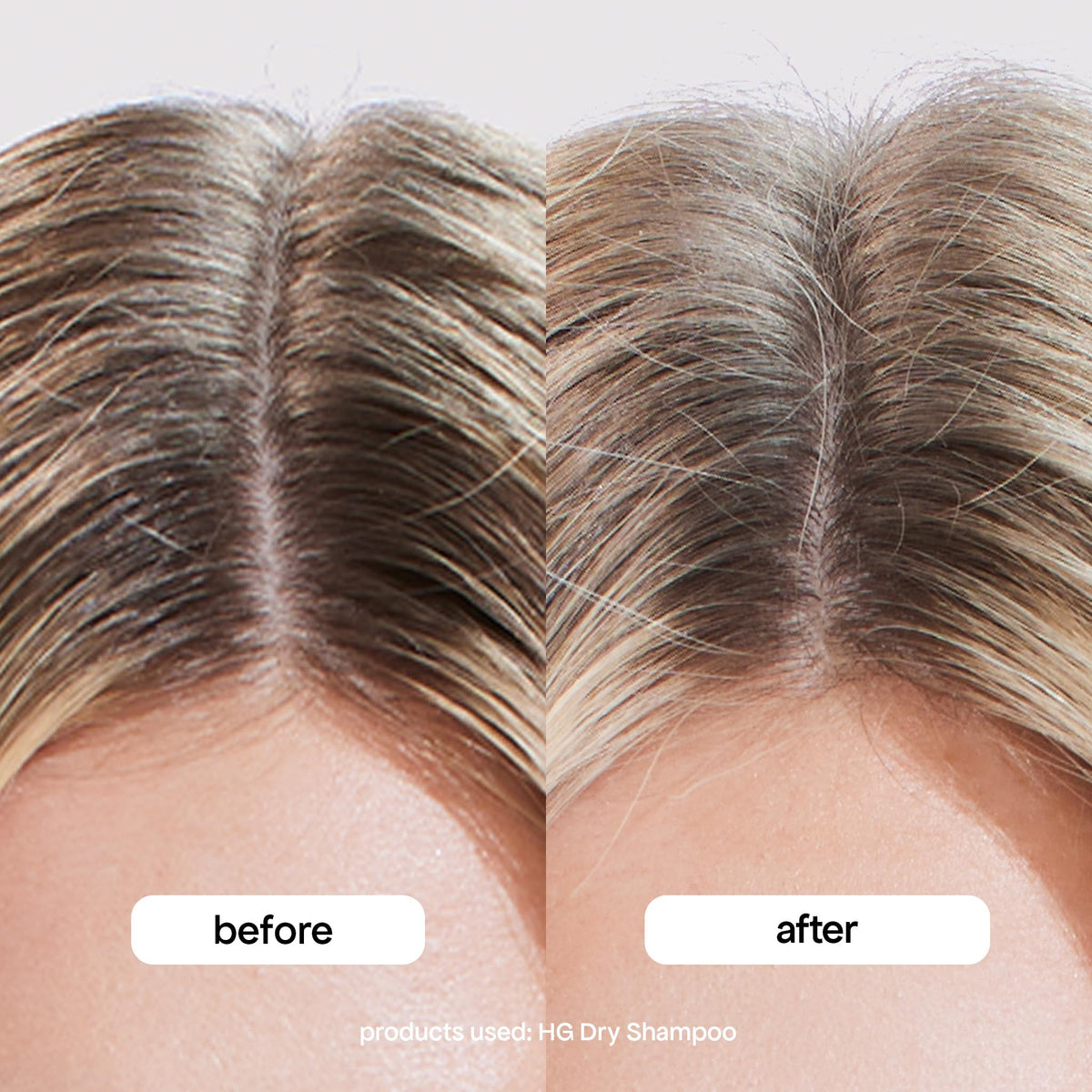 BONDIBOOST before and after root volume comparison showing fuller hair